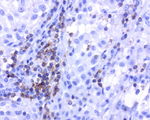 CD2 Antibody in Immunohistochemistry (Paraffin) (IHC (P))