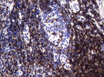 CD2 Antibody in Immunohistochemistry (Paraffin) (IHC (P))