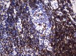 CD2 Antibody in Immunohistochemistry (Paraffin) (IHC (P))