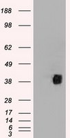 CD2 Antibody in Western Blot (WB)