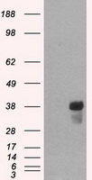 CD2 Antibody in Western Blot (WB)