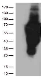 CD2 Antibody in Western Blot (WB)