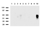 CD2 Antibody in Western Blot (WB)
