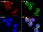 CD20 (MS4A1) Antibody in Immunocytochemistry (ICC/IF)