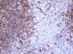 CD20 (MS4A1) Antibody in Immunohistochemistry (Paraffin) (IHC (P))