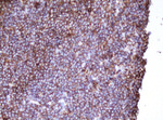 CD20 (MS4A1) Antibody in Immunohistochemistry (Paraffin) (IHC (P))