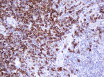 CD20 (MS4A1) Antibody in Immunohistochemistry (Paraffin) (IHC (P))