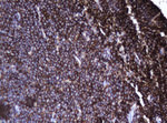 CD20 (MS4A1) Antibody in Immunohistochemistry (Paraffin) (IHC (P))