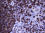 CD20 (MS4A1) Antibody in Immunohistochemistry (Paraffin) (IHC (P))