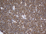 CD20 (MS4A1) Antibody in Immunohistochemistry (Paraffin) (IHC (P))