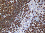 CD20 (MS4A1) Antibody in Immunohistochemistry (Paraffin) (IHC (P))