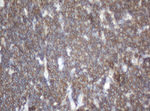 CD20 (MS4A1) Antibody in Immunohistochemistry (Paraffin) (IHC (P))
