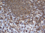 CD20 (MS4A1) Antibody in Immunohistochemistry (Paraffin) (IHC (P))