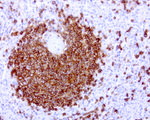 CD20 (MS4A1) Antibody in Immunohistochemistry (Paraffin) (IHC (P))