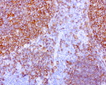 CD20 (MS4A1) Antibody in Immunohistochemistry (Paraffin) (IHC (P))