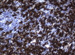 CD20 (MS4A1) Antibody in Immunohistochemistry (Paraffin) (IHC (P))