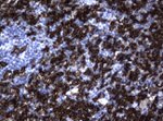 CD20 (MS4A1) Antibody in Immunohistochemistry (Paraffin) (IHC (P))