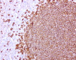 CD20 (MS4A1) Antibody in Immunohistochemistry (Paraffin) (IHC (P))