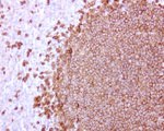 CD20 (MS4A1) Antibody in Immunohistochemistry (Paraffin) (IHC (P))