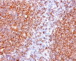 CD20 (MS4A1) Antibody in Immunohistochemistry (Paraffin) (IHC (P))