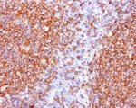 CD20 (MS4A1) Antibody in Immunohistochemistry (Paraffin) (IHC (P))