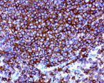CD20 (MS4A1) Antibody in Immunohistochemistry (Paraffin) (IHC (P))