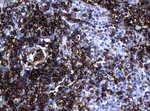 CD20 (MS4A1) Antibody in Immunohistochemistry (Paraffin) (IHC (P))