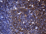 CD20 (MS4A1) Antibody in Immunohistochemistry (Paraffin) (IHC (P))