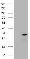 CD20 (MS4A1) Antibody in Western Blot (WB)
