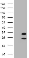CD20 (MS4A1) Antibody in Western Blot (WB)