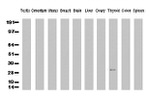CD20 (MS4A1) Antibody in Western Blot (WB)