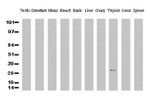 CD20 (MS4A1) Antibody in Western Blot (WB)