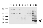 CD20 (MS4A1) Antibody in Western Blot (WB)