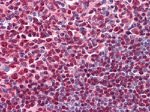 CD20 Antibody in Immunohistochemistry (Paraffin) (IHC (P))