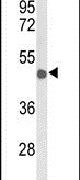 DC-SIGN Antibody in Western Blot (WB)