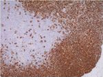 CD20 Antibody in Immunohistochemistry (Paraffin) (IHC (P))