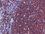 CD20 Antibody in Immunohistochemistry (IHC)