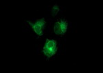 CD22 Antibody in Immunocytochemistry (ICC/IF)