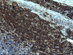 CD22 Antibody in Immunohistochemistry (Paraffin) (IHC (P))