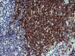 CD22 Antibody in Immunohistochemistry (Paraffin) (IHC (P))