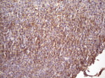 CD22 Antibody in Immunohistochemistry (Paraffin) (IHC (P))