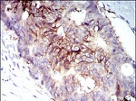 IGF1R beta Antibody in Immunohistochemistry (Paraffin) (IHC (P))