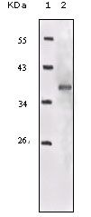IGF1R beta Antibody in Western Blot (WB)