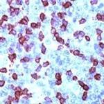 CD3e Antibody in Immunohistochemistry (IHC)