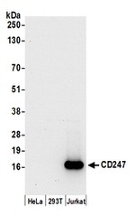 CD247/CD3Z Antibody in Western Blot (WB)