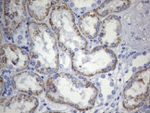 CD248 Antibody in Immunohistochemistry (Paraffin) (IHC (P))