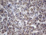 CD248 Antibody in Immunohistochemistry (Paraffin) (IHC (P))