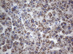 CD248 Antibody in Immunohistochemistry (Paraffin) (IHC (P))