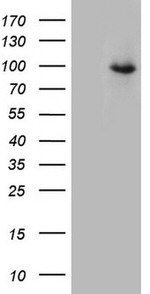 CD248 Antibody in Western Blot (WB)