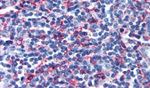 CRTH2 Antibody in Immunohistochemistry (Paraffin) (IHC (P))